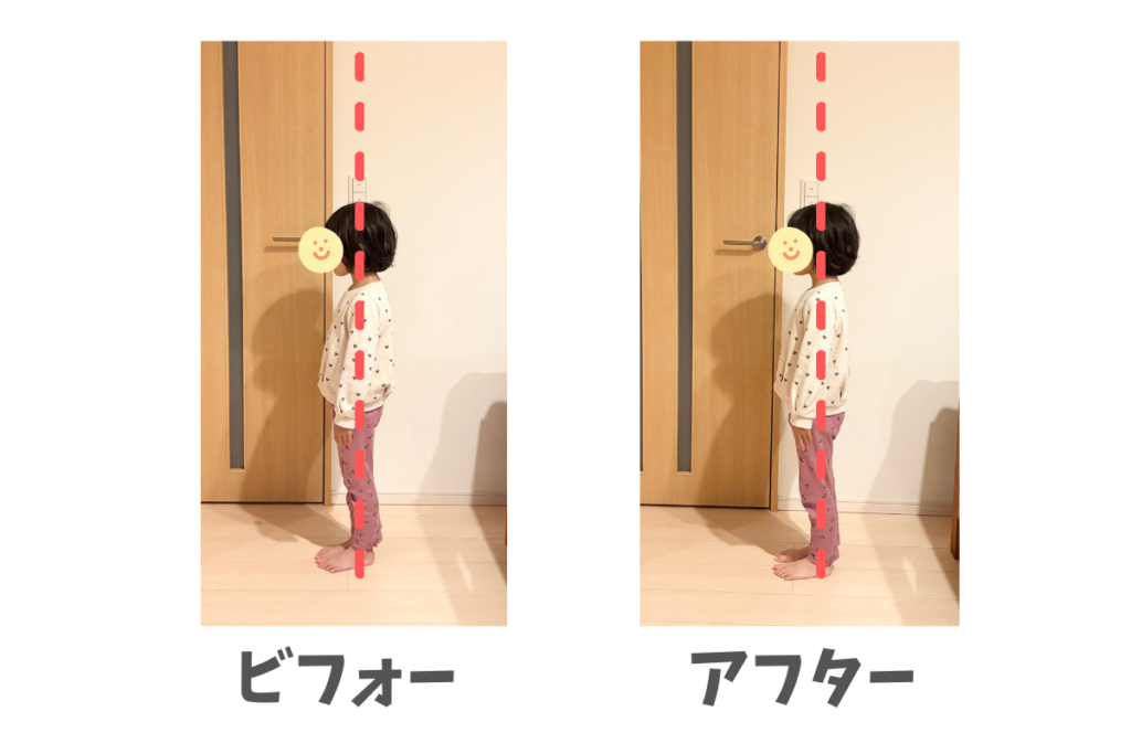 へやスポアシスト　姿勢の変化　年中　立位姿勢